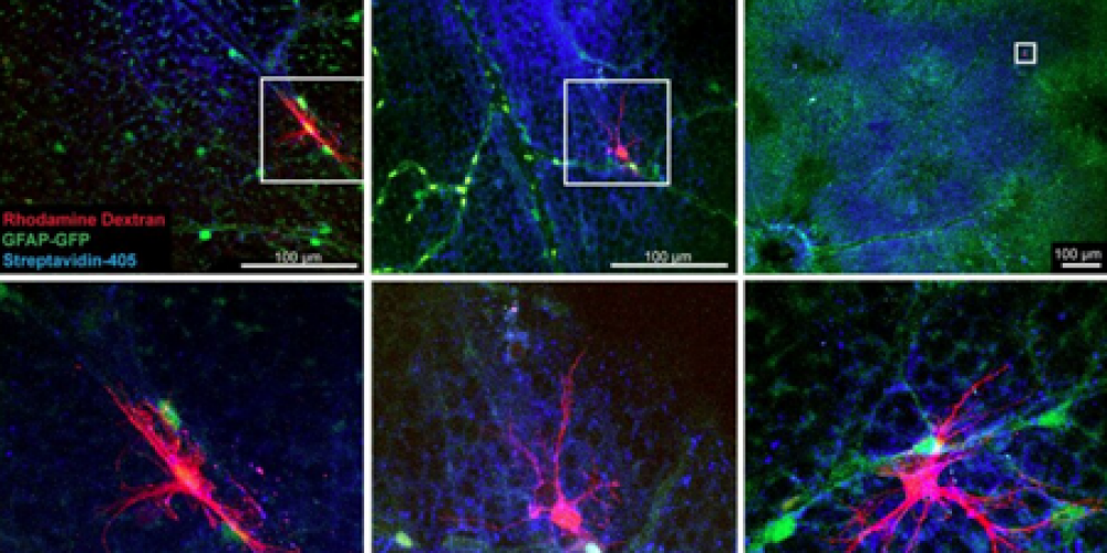 New Approach to Treating Neurodegenerative Eye Disease